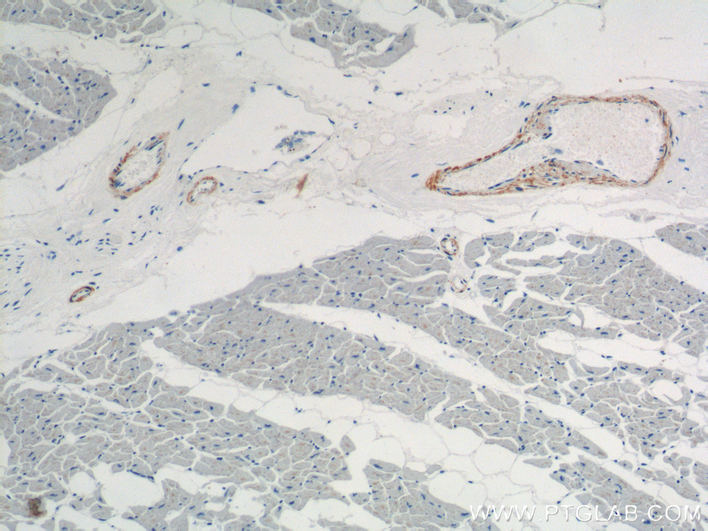 IHC staining of human heart using 15502-1-AP