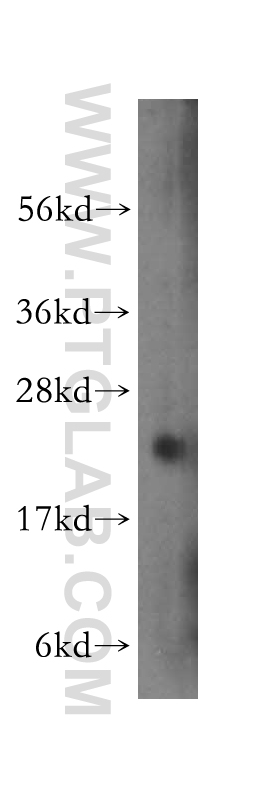 transgelin/SM22-specific