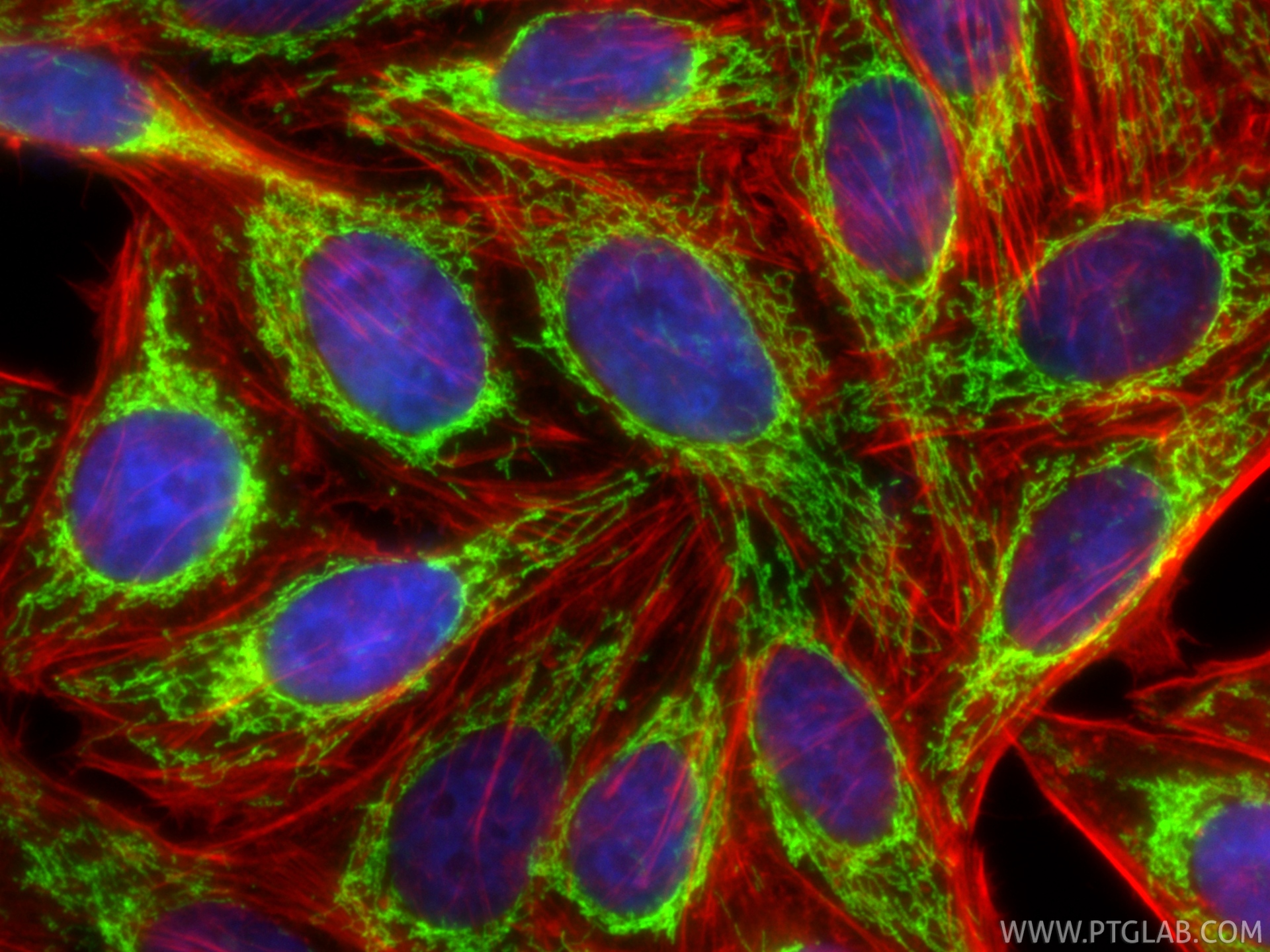 IF Staining of HepG2 using 10325-1-AP IF Staining of HepG2 using 10325-1-AP