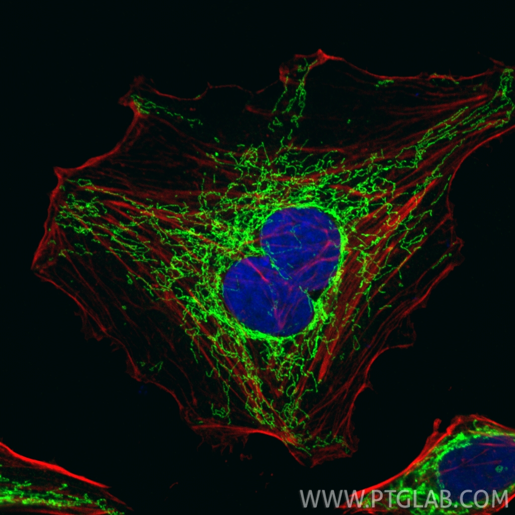 IF Staining of HepG2 using 10325-1-AP IF Staining of HepG2 using 10325-1-AP