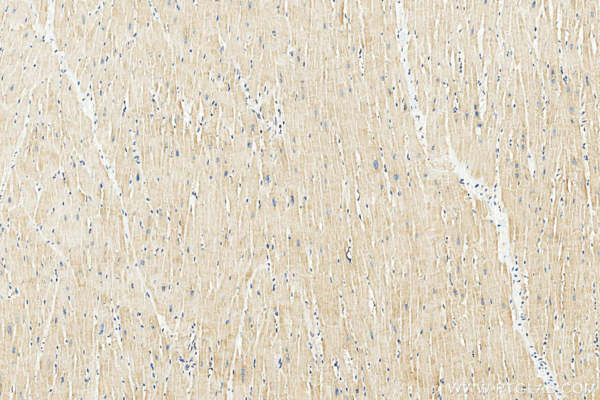 IHC staining of human heart using 10325-1-AP