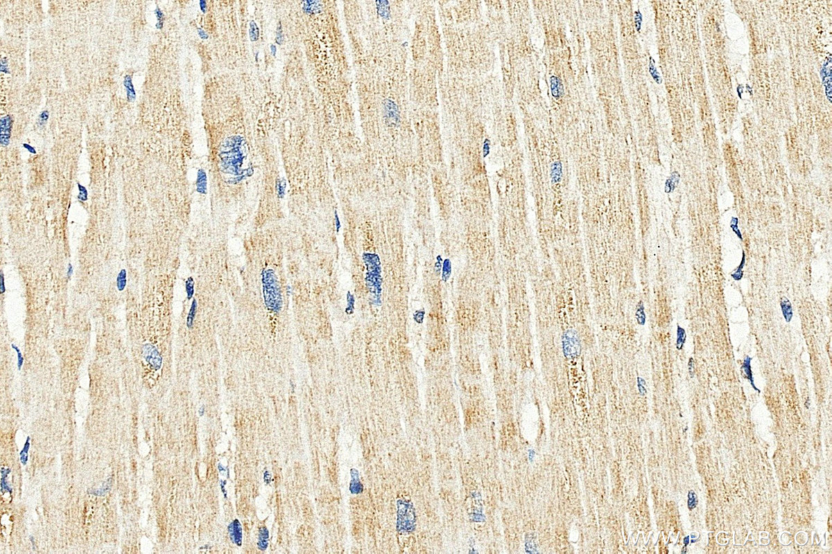 IHC staining of human heart using 10325-1-AP