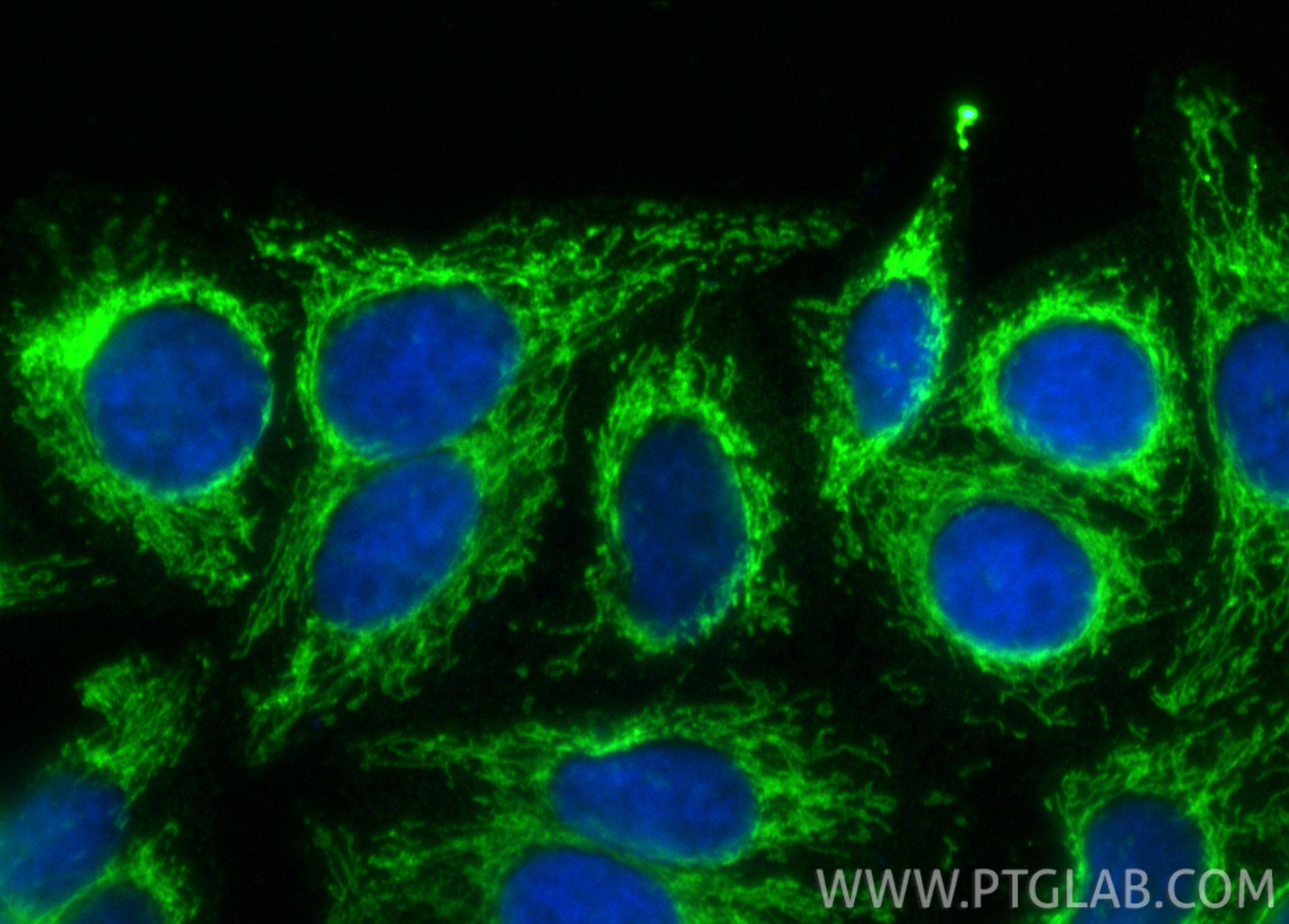 IF Staining of HepG2 using 67693-1-Ig IF Staining of HepG2 using 67693-1-Ig