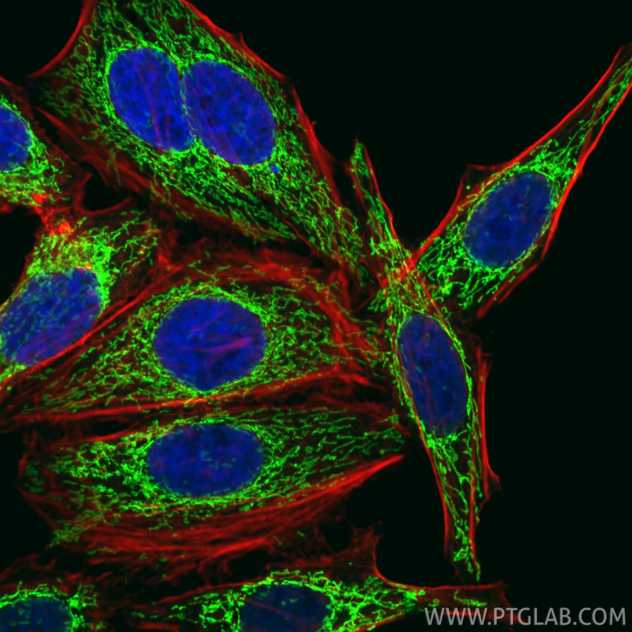 IF Staining of HepG2 using CL488-10325 IF Staining of HepG2 using CL488-10325