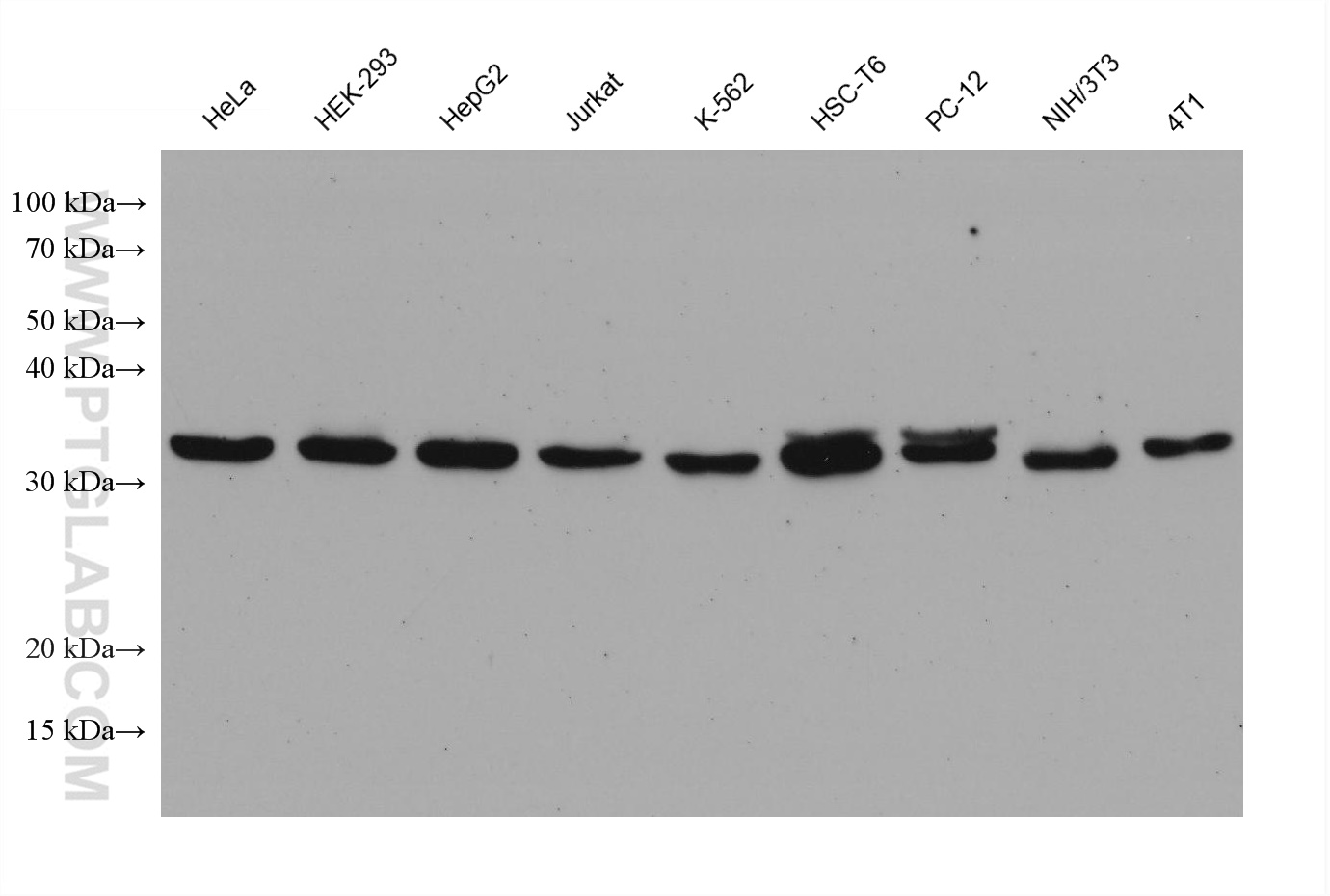 WB analysis using 67925-1-Ig (same clone as 67925-1-PBS)