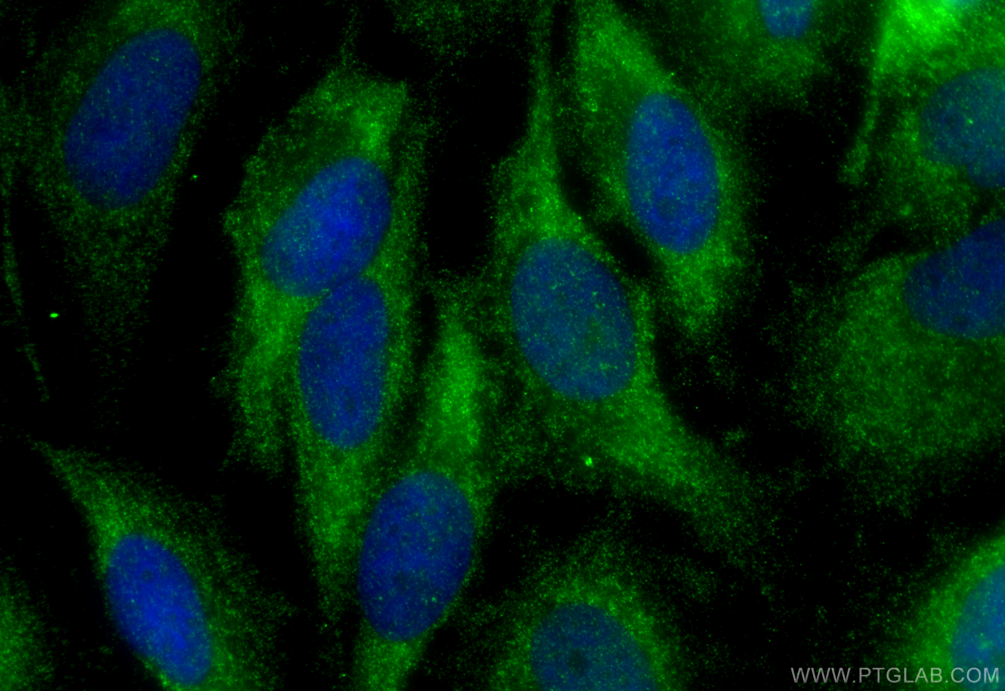 IF Staining of HeLa using 13868-1-AP