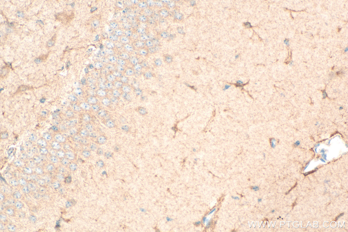 IHC staining of mouse brain using 13868-1-AP