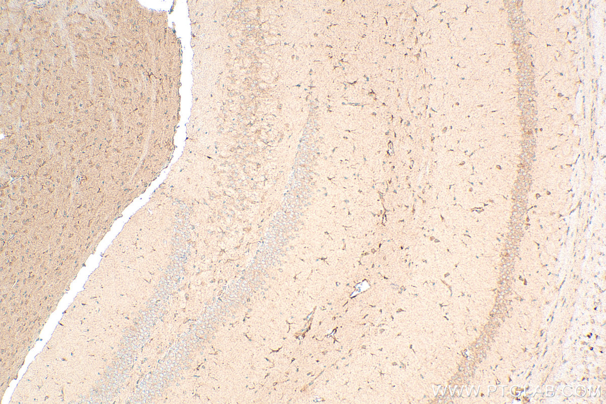 IHC staining of mouse brain using 13868-1-AP