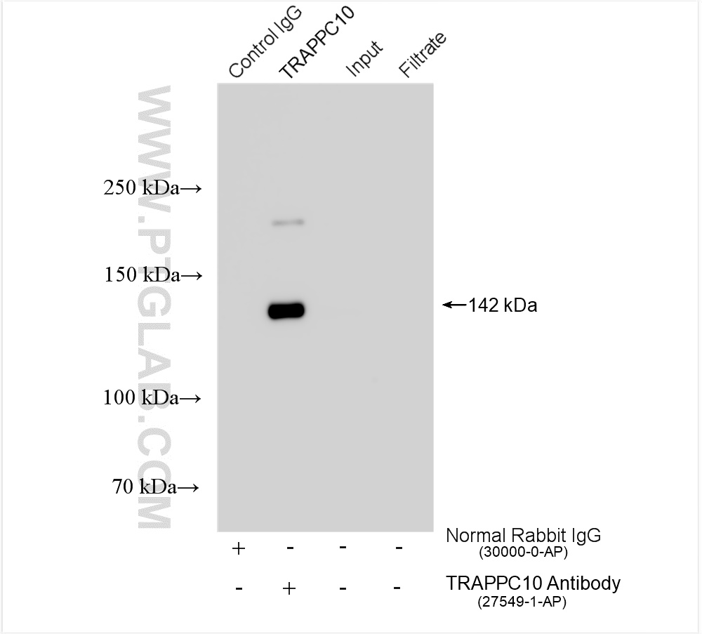 IP experiment of mouse brain using 27549-1-AP