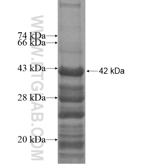 TRAPPC10 fusion protein Ag12696 SDS-PAGE