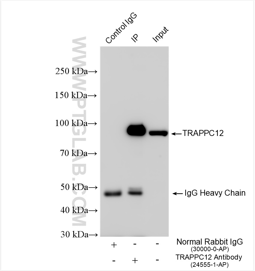 IP experiment of K-562 using 24555-1-AP