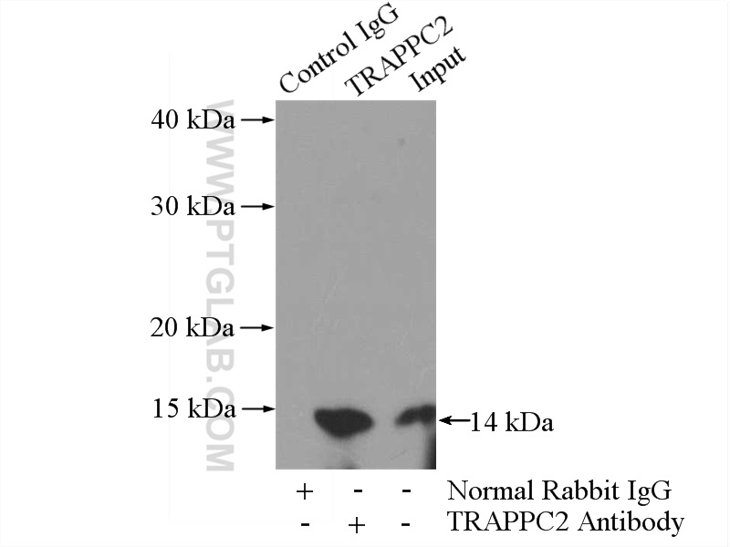 IP experiment of PC-3 using 12484-1-AP