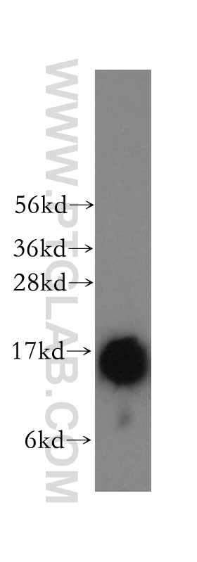 WB analysis of human brain using 12484-1-AP