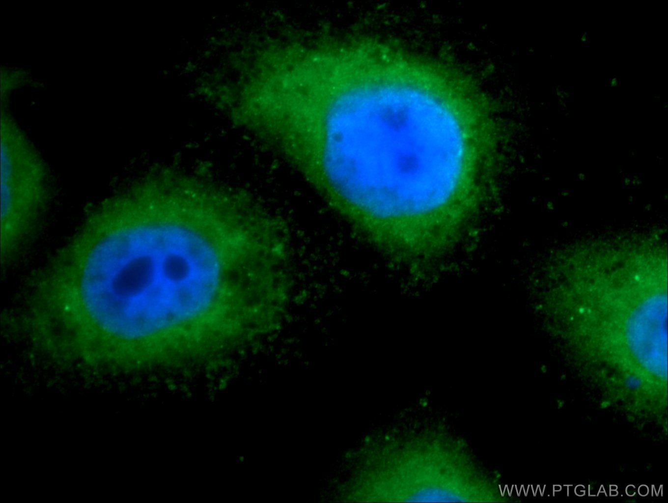 IF Staining of HepG2 using 25282-1-AP