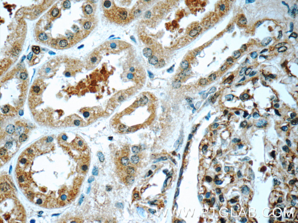 IHC staining of human kidney using 25282-1-AP