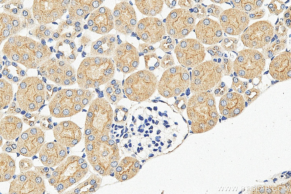 IHC staining of mouse kidney using 25282-1-AP