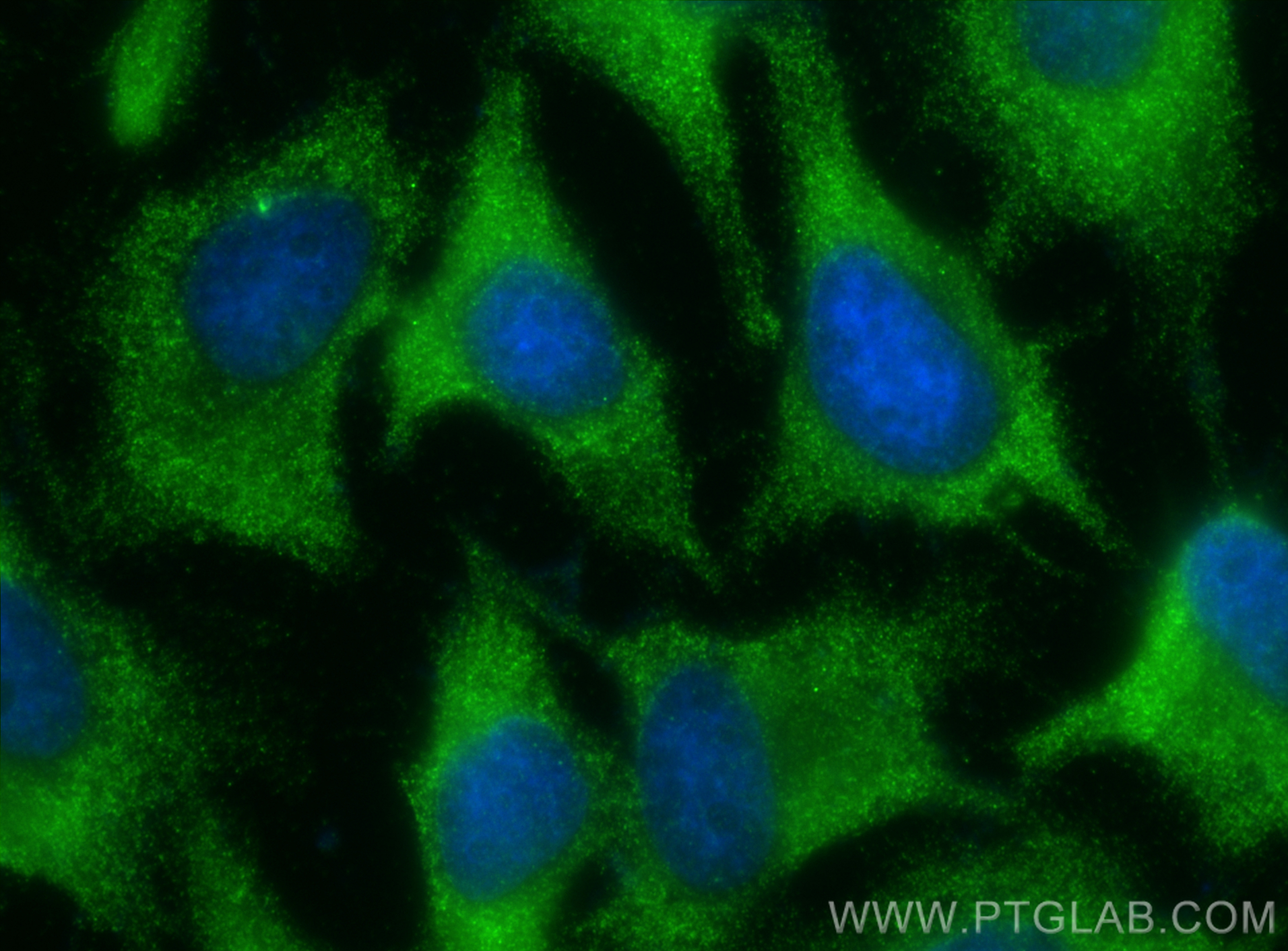 IF Staining of HeLa using 15555-1-AP