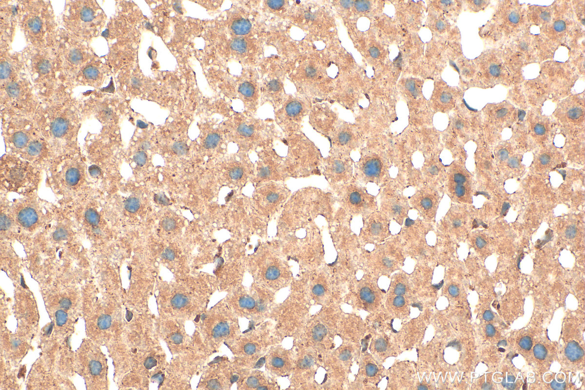 Immunohistochemical analysis of paraffin-embedded mouse liver tissue slide using 12074-1-AP (TRAPPC4 antibody) at dilution of 1:100 (under 40x lens). Heat mediated antigen retrieval with Tris-EDTA buffer (pH 9.0). IHC staining of mouse liver using 12074-1-AP