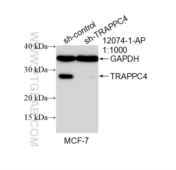 WB analysis of MCF-7 using 12074-1-AP