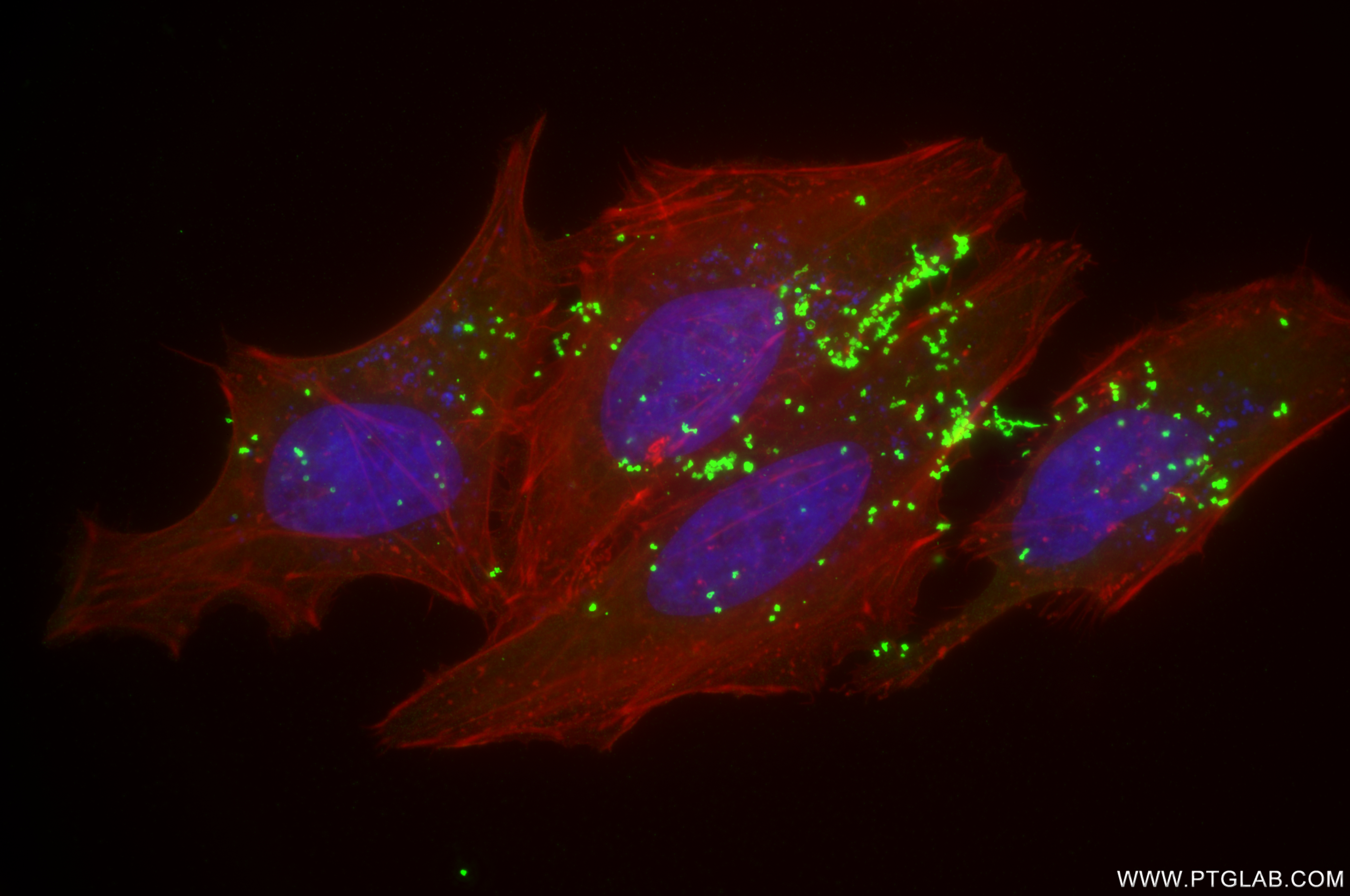 IF Staining of HeLa using 84119-3-RR (same clone as 84119-3-PBS)