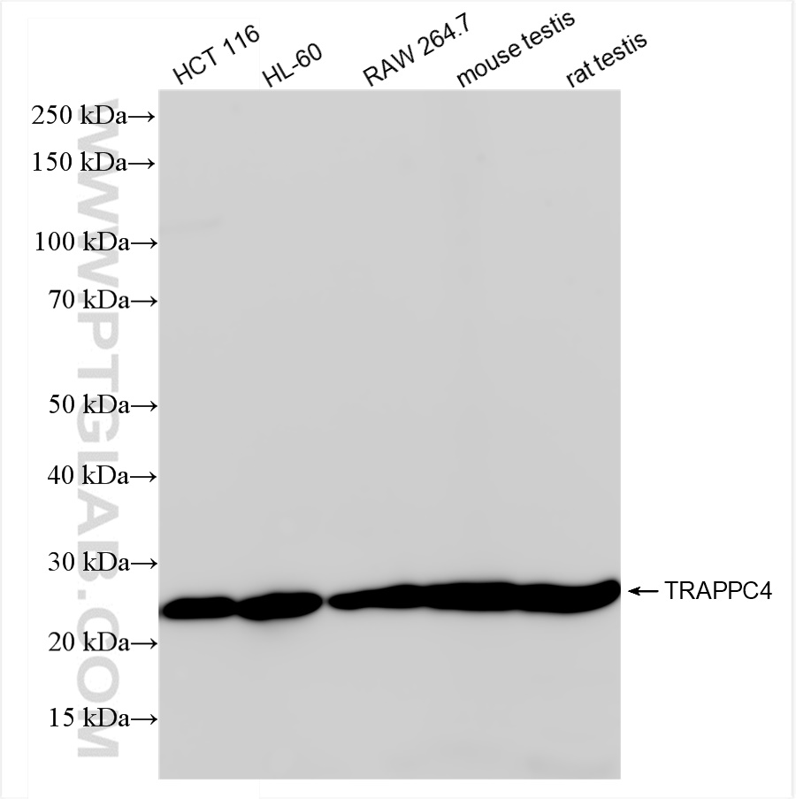 WB analysis using 84119-3-RR