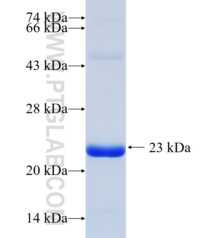 TRAPPC6A fusion protein Ag7492 SDS-PAGE