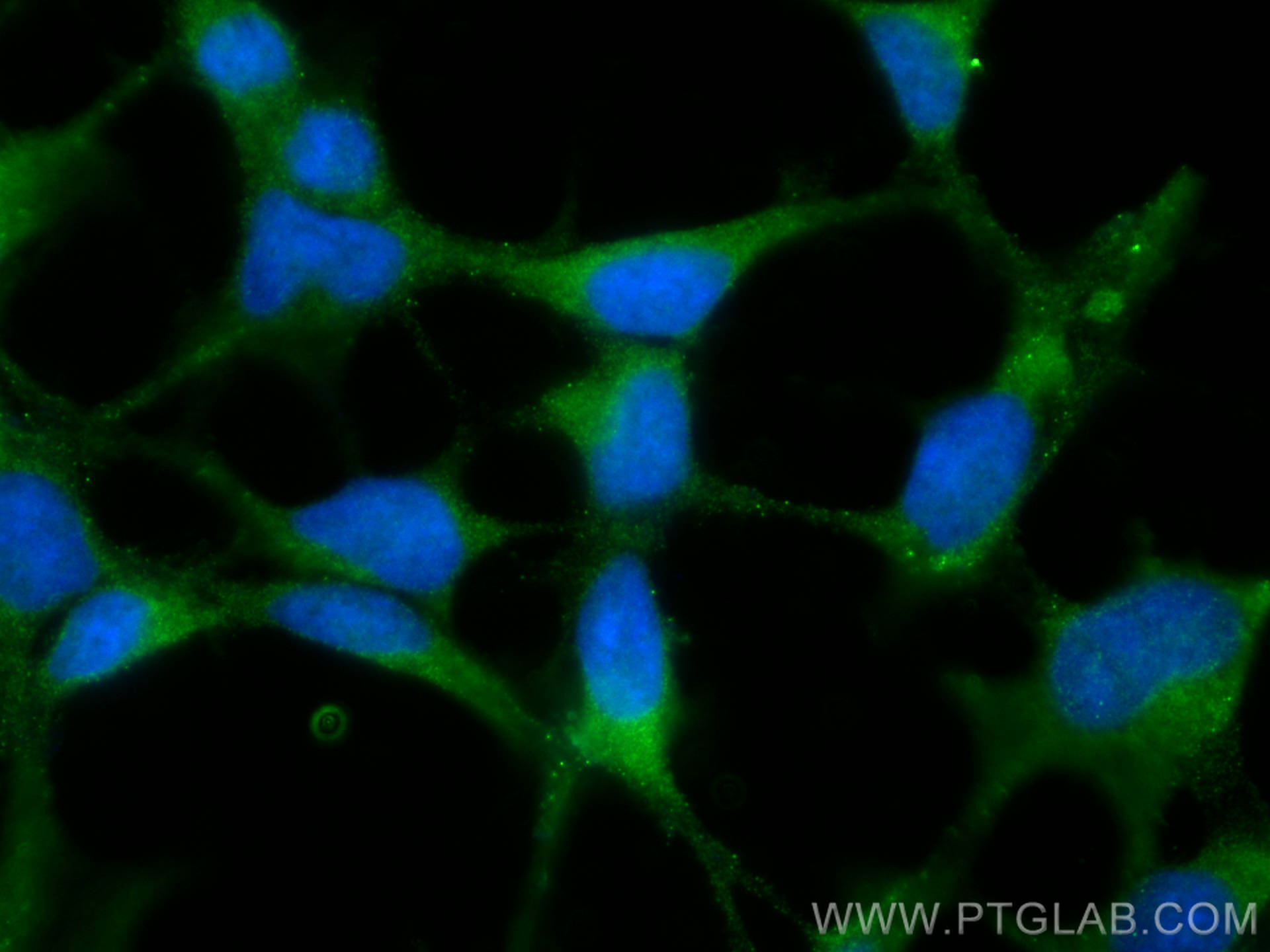 IF Staining of HEK-293 using 16014-1-AP