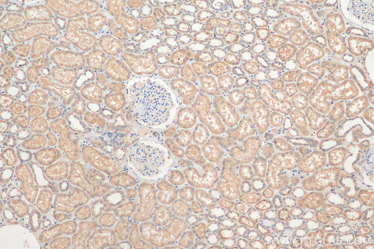 IHC staining of human kidney using 16014-1-AP