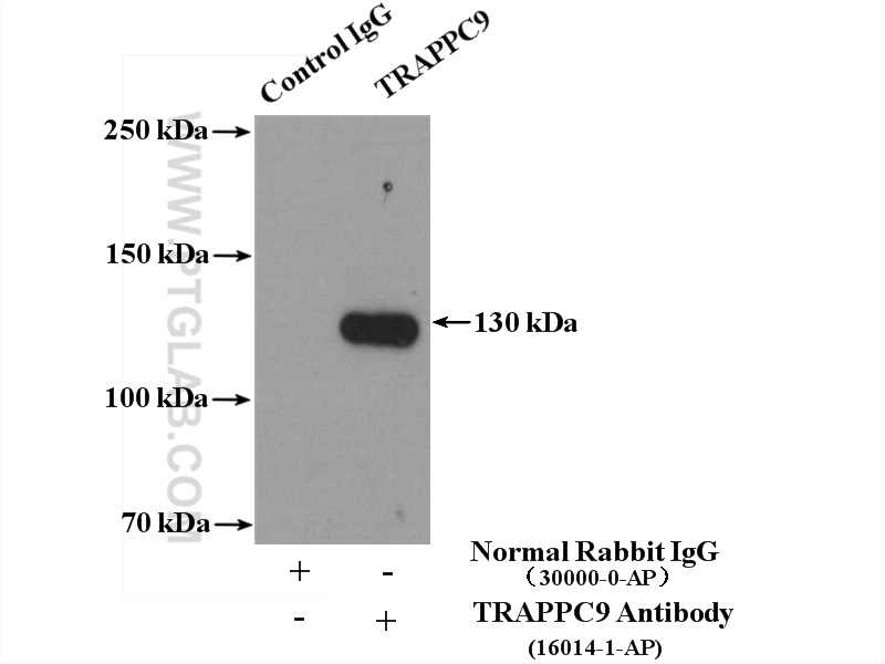 IP experiment of mouse brain using 16014-1-AP