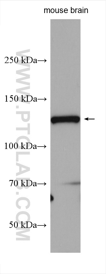 WB analysis of mouse brain using 16014-1-AP