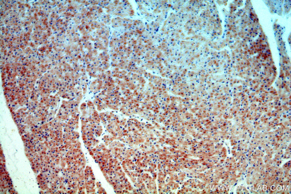 IHC staining of human heart using 19549-1-AP