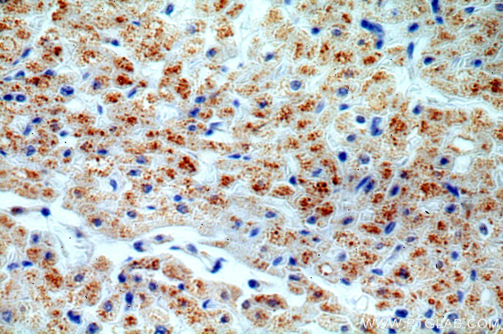 IHC staining of human heart using 19549-1-AP