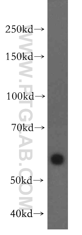 WB analysis of SH-SY5Y using 19549-1-AP