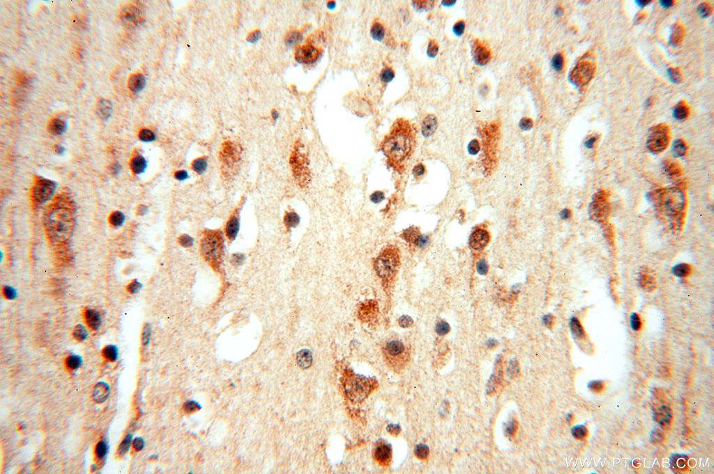 IHC staining of human brain using 15753-1-AP