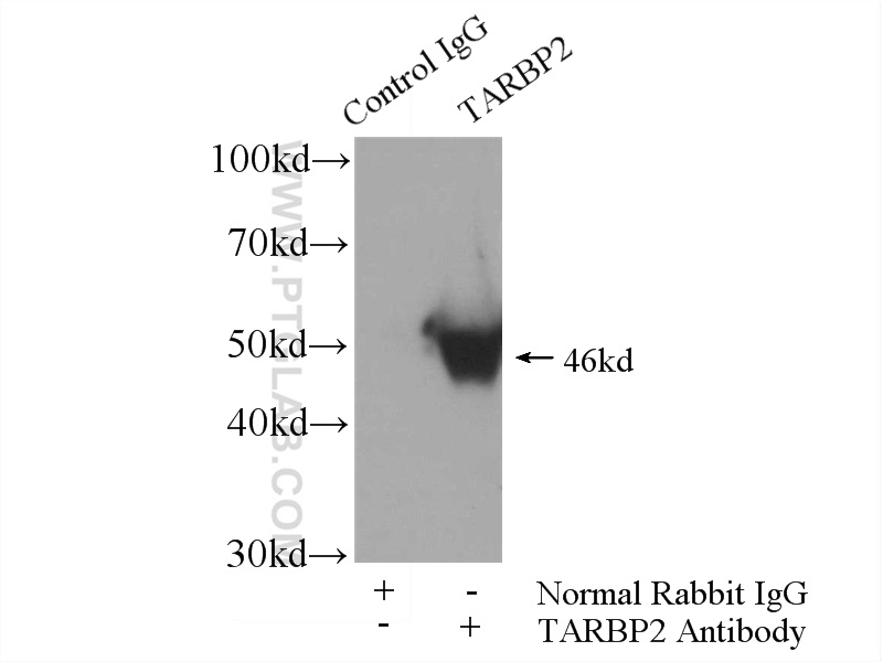 IP experiment of mouse liver using 15753-1-AP