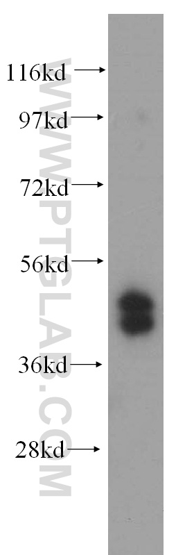 WB analysis of HepG2 using 15753-1-AP