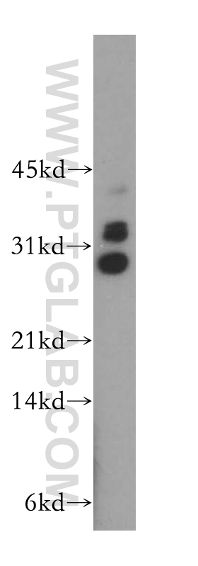 TRBV5-4