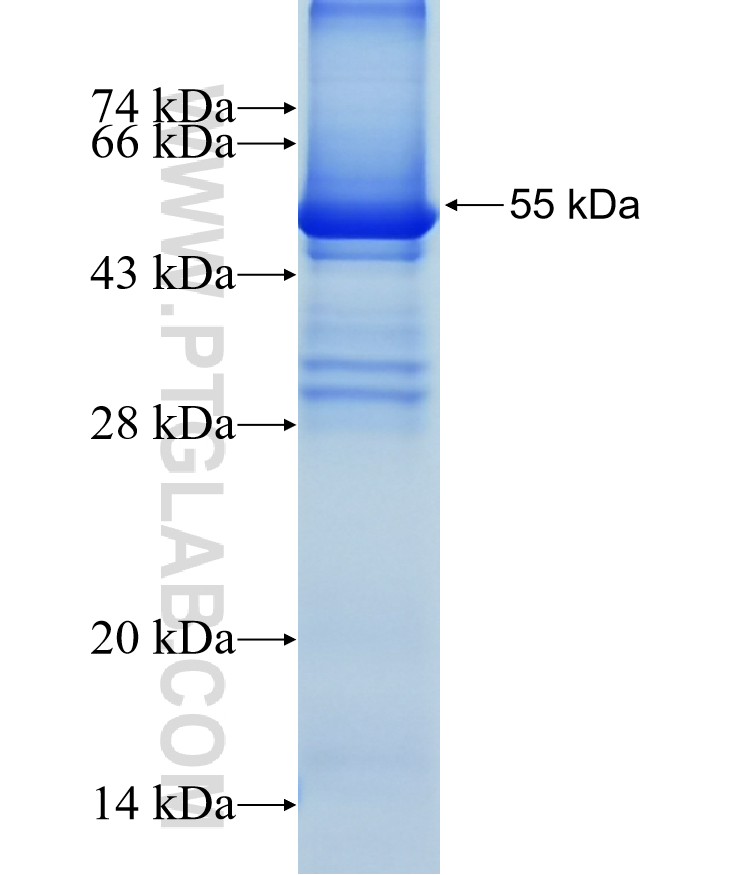 TRDV2 fusion protein Ag4560 SDS-PAGE