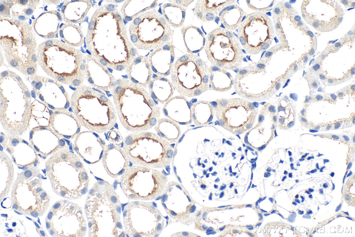 IHC staining of mouse kidney using 26807-1-AP