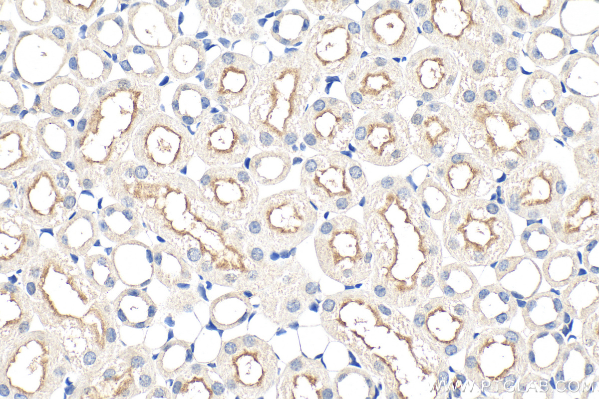 IHC staining of mouse kidney using 26807-1-AP