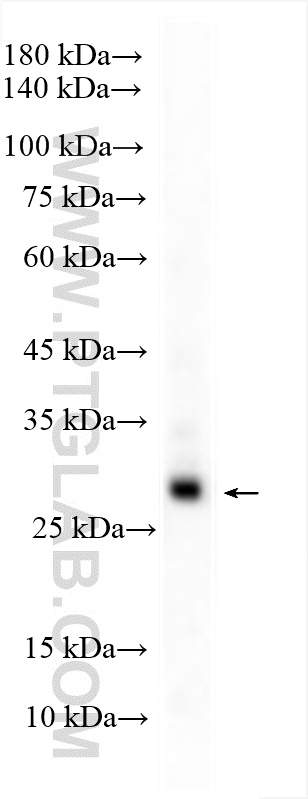 WB analysis of human peripheral blood leukocyte using 11791-1-AP