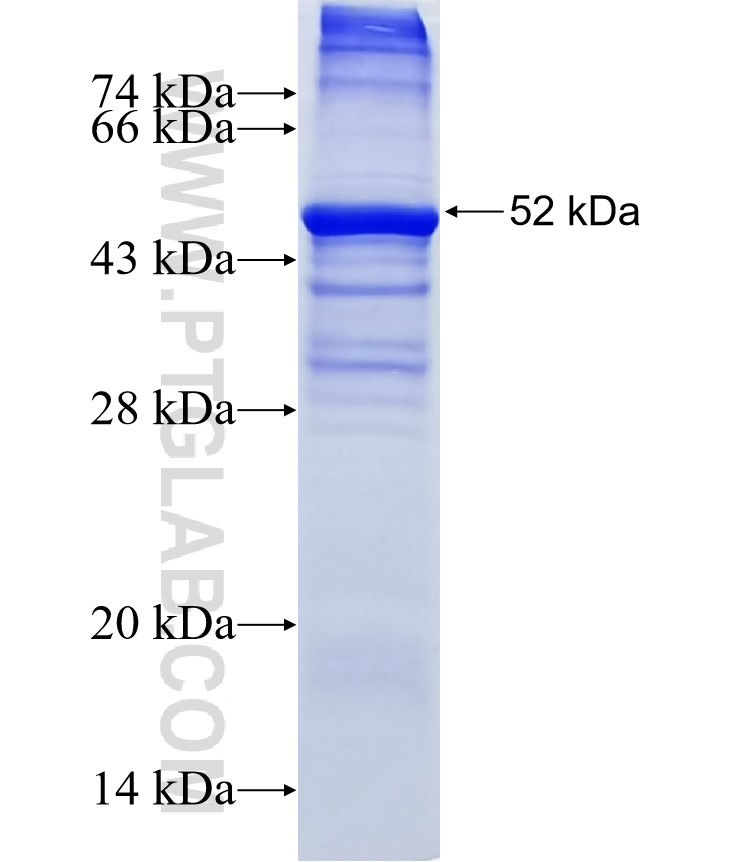 TREM1 fusion protein Ag2418 SDS-PAGE