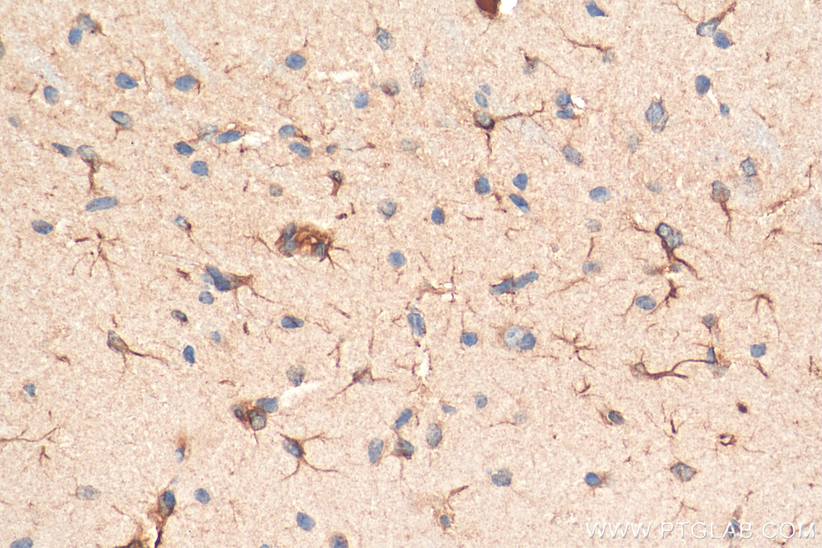 IHC staining of mouse brain using 13483-1-AP