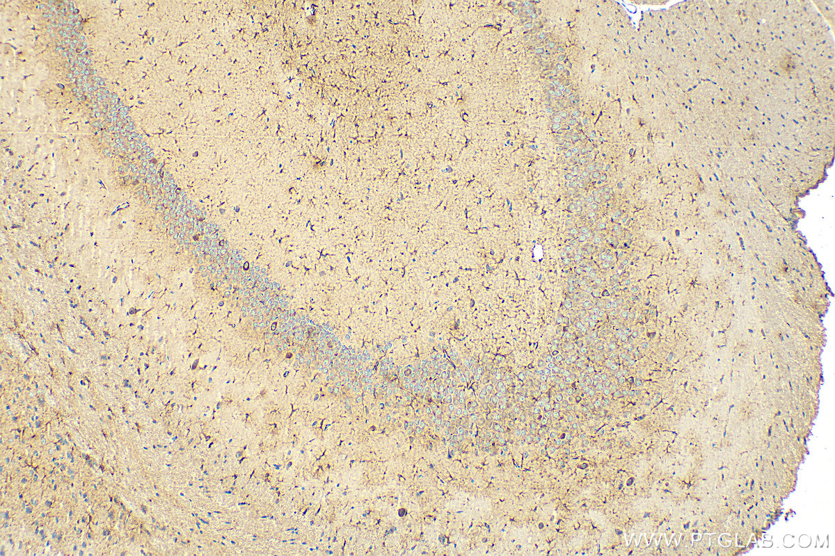 IHC staining of mouse brain using 68723-1-Ig (same clone as 68723-1-PBS)