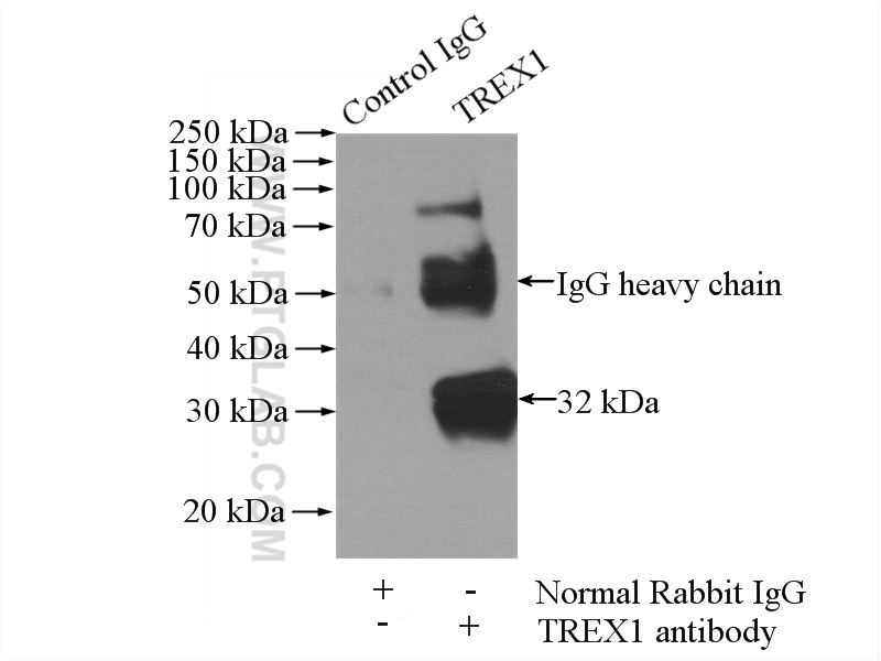 IP experiment of HeLa using 24876-1-AP