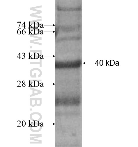 TRGV7 fusion protein Ag13472 SDS-PAGE TRGV7 fusion protein Ag13472 SDS-PAGE