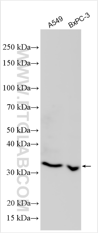 WB analysis using 25332-1-AP