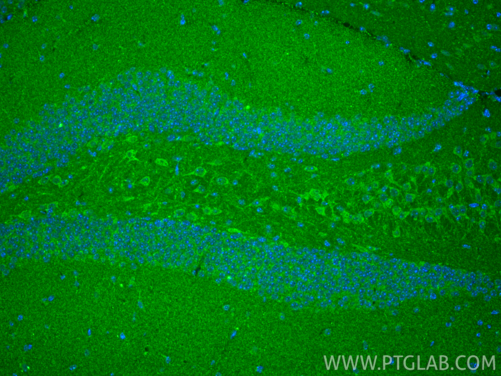 IF Staining of mouse brain using 15351-1-AP IF Staining of mouse brain using 15351-1-AP