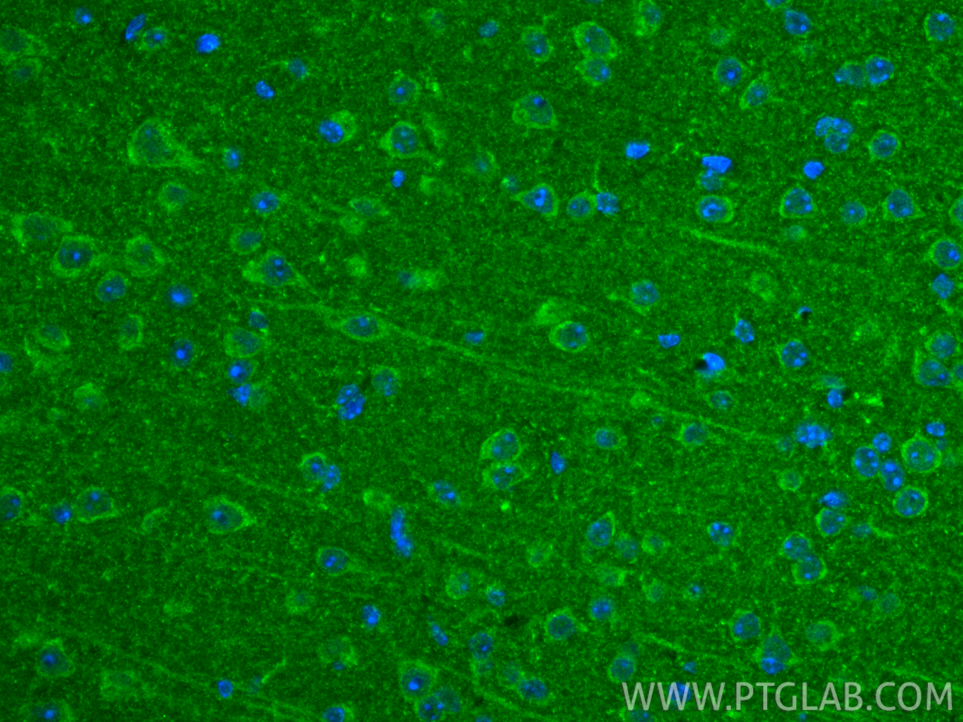 IF Staining of mouse brain using 15351-1-AP IF Staining of mouse brain using 15351-1-AP