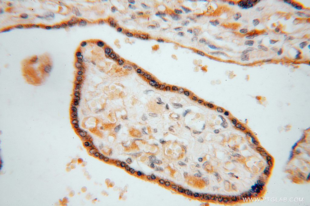 IHC staining of human placenta using 15359-1-AP